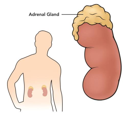 overactivity of the adrenal gland medical term